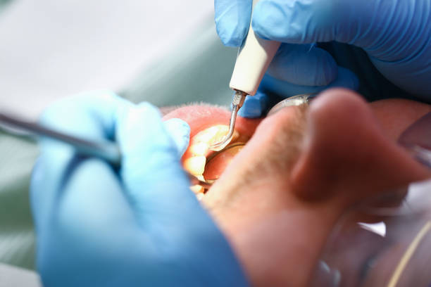 Best Pediatric Emergency Dentist in Folsom, PA