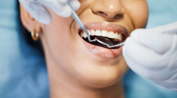 Best Mobile Emergency Dentist in Folsom, PA